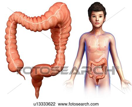 Stock Image - Megacolon, illustration. Fotosearch