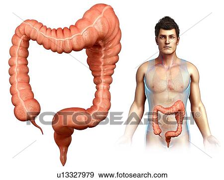 Megacolon, illustration View Large Photo Image Stock Photo - Megacolon, illustration. Fotosearch