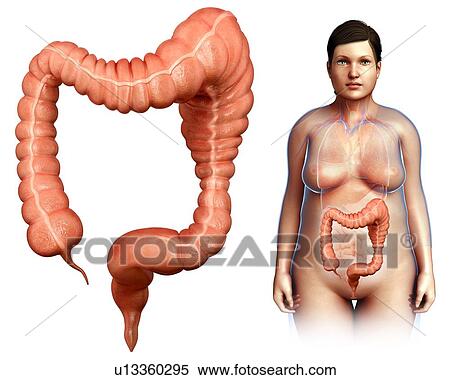Megacolon, illustration View Large Photo Image Stock Photography - Megacolon, illustration. Fotosearch
