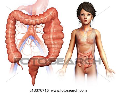 Stock Photography - Megacolon, illustration. Fotosearch