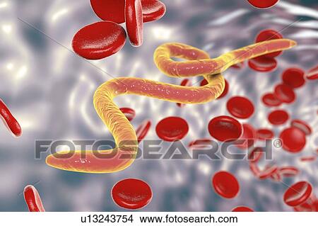 Microfilaria worms in blood, illustration View Large Photo Image Picture - Microfilaria worms in blood, illustration. Fotosearch