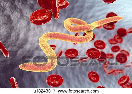 Microfilaria worms in blood, illustration View Large Photo Image Stock Photo - Microfilaria worms in blood, illustration. Fotosearch