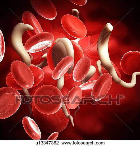 Stock Image - Sleeping sickness parasites, illustration. Fotosearch