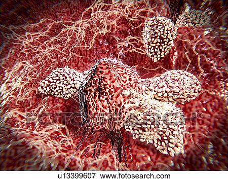 Stock Photo - T-lymphocytes attacking a cancer cell. Fotosearch