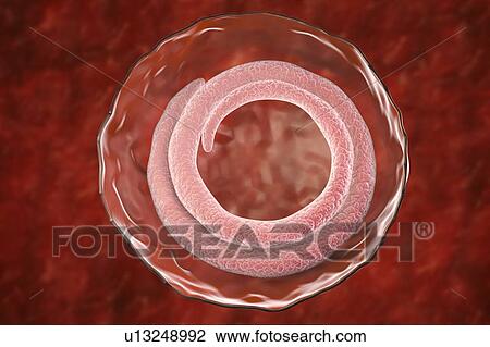 Trichina roundworm, illustration View Large Photo Image Stock Image - Trichina roundworm, illustration. Fotosearch