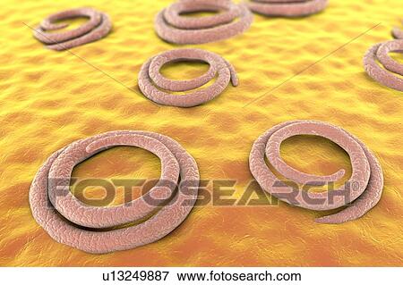 Trichina roundworm, illustration View Large Photo Image Stock Photo - Trichina roundworm, illustration. Fotosearch