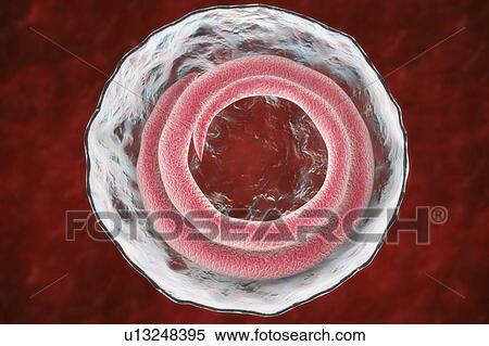 Trichina roundworm, illustration View Large Photo Image Stock Photography - Trichina roundworm, illustration. Fotosearch