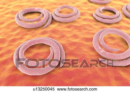 Trichina roundworm, illustration View Large Photo Image Stock Photography - Trichina roundworm, illustration. Fotosearch