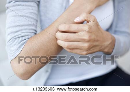 Woman scratching her arm View Large Photo Image Stock Image - Woman scratching her arm. Fotosearch