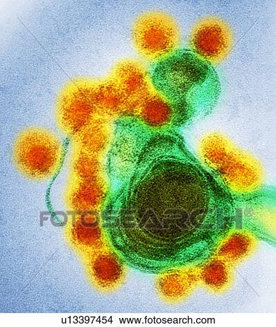 Zika virus particles, TEM View Large Photo Image Picture - Zika virus particles, TEM. Fotosearch