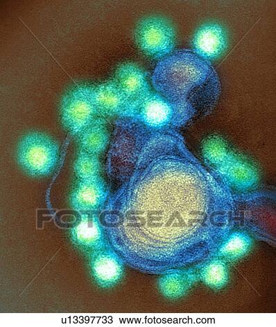 Zika virus particles, TEM View Large Photo Image Stock Image - Zika virus particles, TEM. Fotosearch