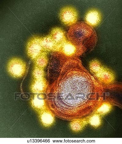 Zika virus particles, TEM View Large Photo Image Stock Photograph - Zika virus particles, TEM. Fotosearch