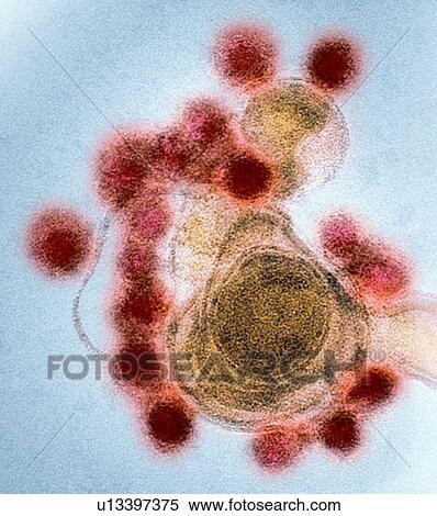 Zika virus particles, TEM View Large Photo Image Stock Photography - Zika virus particles, TEM. Fotosearch