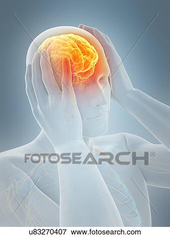 Stock Photo - Anatomy of person with headache, illustration. Fotosearch