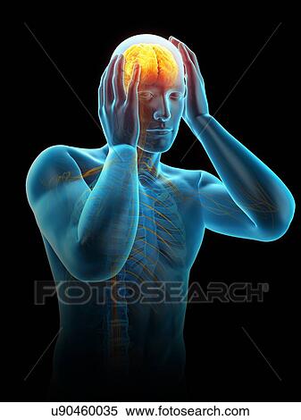 Stock Photography - Anatomy of person with headache, illustration. Fotosearch