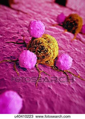 Stock Image - Cancer cells, illustration. Fotosearch