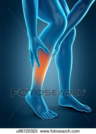 Stock Photography - Human calf pain, illustration. Fotosearch