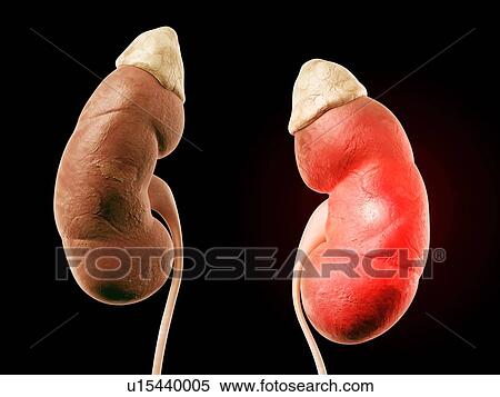 Human kidneys, illustration View Large Photo Image Stock Photography - Human kidneys, illustration. Fotosearch