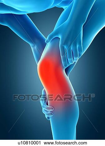 Human knee pain, illustration View Large Photo Image Stock Image - Human knee pain, illustration. Fotosearch