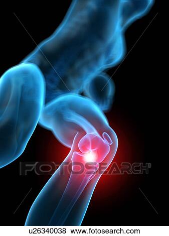 Human knee pain, illustration View Large Photo Image Stock Photo - Human knee pain, illustration. Fotosearch