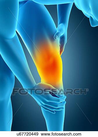 Stock Photo - Human knee pain, illustration. Fotosearch