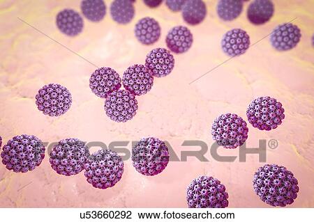 Stock Image - Human papilloma virus, illustration. Fotosearch