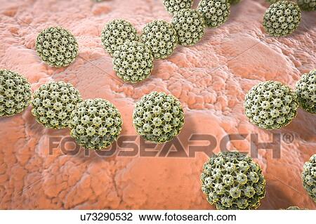 Stock Image - Human papilloma virus, illustration. Fotosearch