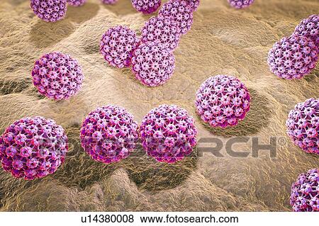 Stock Photo - Human papilloma virus, illustration. Fotosearch