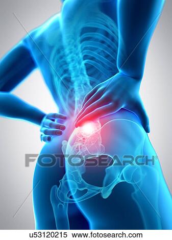 Stock Photography - Human spine and back pain, illustration. Fotosearch