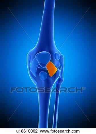 Knee ligament, illustration View Large Photo Image Stock Image - Knee ligament, illustration. Fotosearch