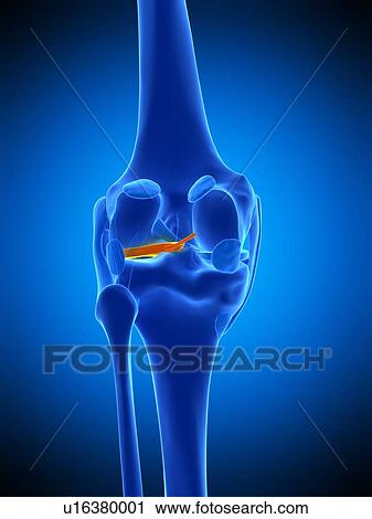 Knee meniscus, illustration View Large Photo Image Stock Image - Knee meniscus, illustration. Fotosearch