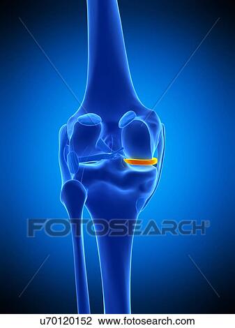 Knee meniscus, illustration View Large Photo Image Stock Image - Knee meniscus, illustration. Fotosearch