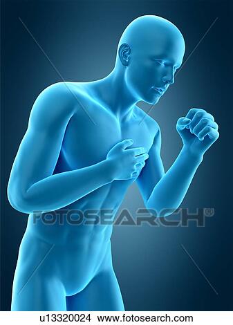 Picture - Person coughing, illustration. Fotosearch