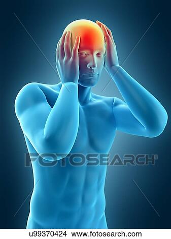 Person with headache, illustration View Large Photo Image Picture - Person with headache, illustration. Fotosearch