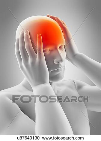 Person with headache, illustration View Large Photo Image Stock Image - Person with headache, illustration. Fotosearch