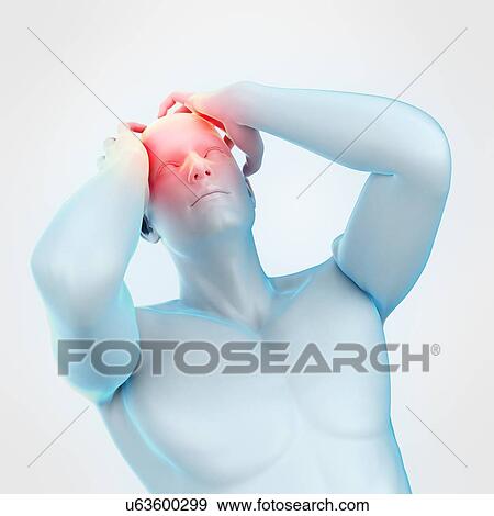 Person with headache, illustration View Large Photo Image Stock Photo - Person with headache, illustration. Fotosearch