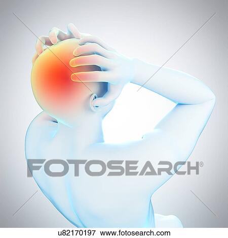 Stock Photo - Person with headache, illustration. Fotosearch