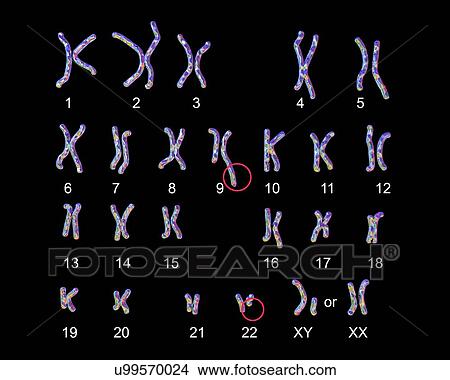 Picture - Philadelphia chromosome, illustration. Fotosearch