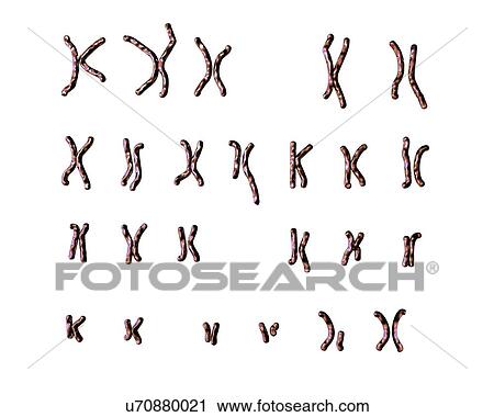 Stock Image - Philadelphia chromosome, illustration. Fotosearch