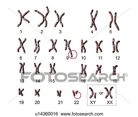 Stock Photograph - Philadelphia chromosome, illustration. Fotosearch