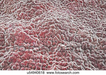 Stock Photo - Stomach lining, illustration. Fotosearch