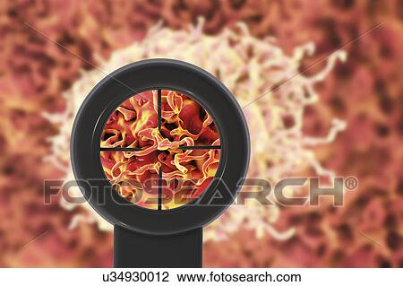 Stock Image - Anticancer treatment. Conceptual illustration. Fotosearch