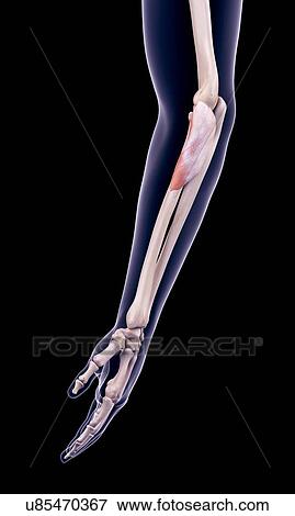Stock Photo - Arm muscle, illustration. Fotosearch