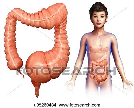 Child with megacolon, illustration View Large Photo Image Picture - Child with megacolon, illustration. Fotosearch