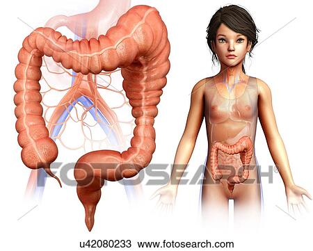 Child with megacolon, illustration View Large Photo Image Stock Image - Child with megacolon, illustration. Fotosearch