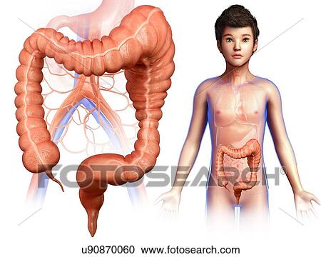 Stock Image - Child with megacolon, illustration. Fotosearch