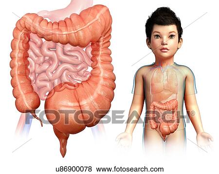 Child with megacolon, illustration View Large Photo Image Stock Photo - Child with megacolon, illustration. Fotosearch