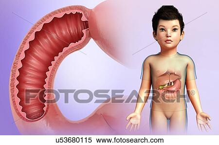 Stock Photography - Child's duodenum, illustration. Fotosearch