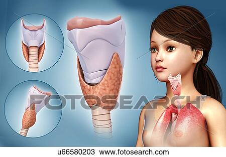 Child's thyroid cartilage, illustration View Large Photo Image Stock Image - Child's thyroid cartilage, illustration. Fotosearch