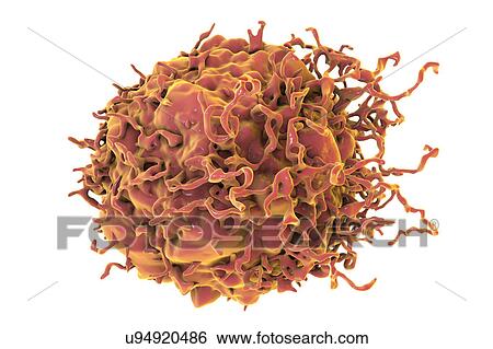 Stock Photograph - Colon cancer cell, illustration. Fotosearch